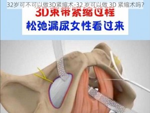 32岁可不可以做3D紧缩术-32 岁可以做 3D 紧缩术吗？